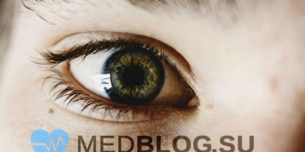 Ирит и иридоциклит Ирит и иридоциклит - в чем различие? Клиника, диагностика и лечение
