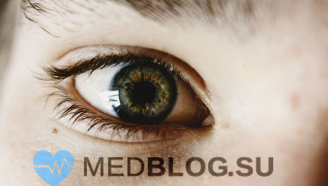 Ирит и иридоциклит - в чем различие? Клиника, диагностика и лечение