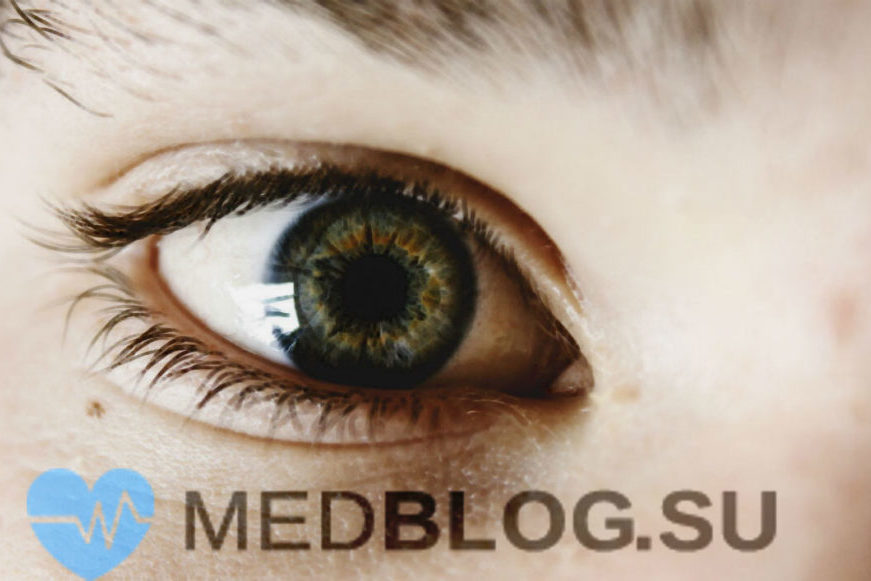 Ирит и иридоциклит Ирит и иридоциклит - в чем различие? Клиника, диагностика и лечение