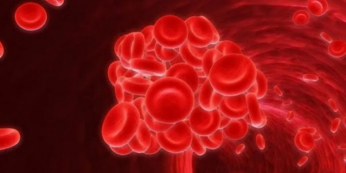 Статья о заболевании, связанном с недостаточностью витамина Б-12 - пернициозная анемия
