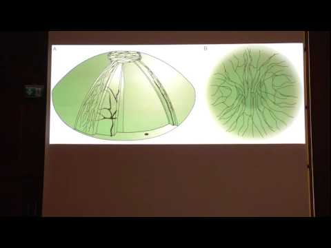 Dry eye. Заболевания глазной поверхности (3) Григорьева Н.Н., Neva horizons-2016.