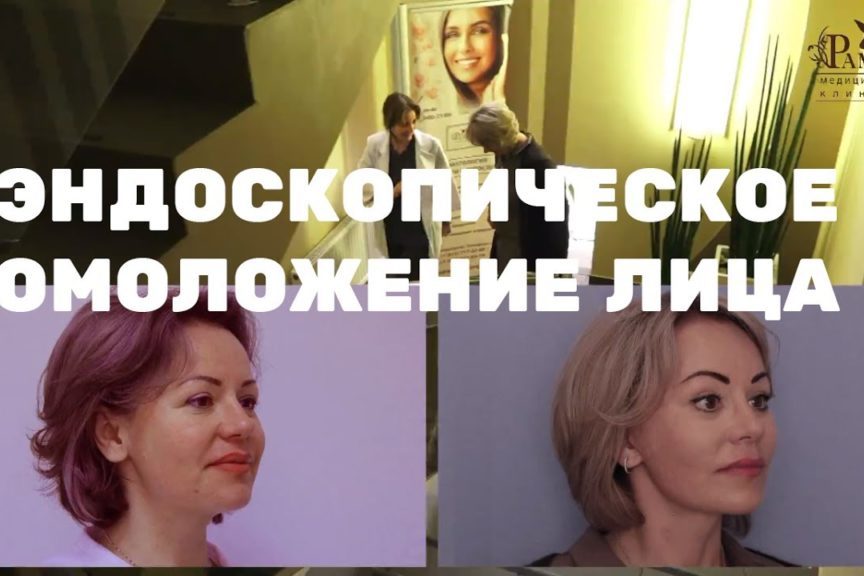 Фейслифтинг (эндоскопическая подтяжка лица)