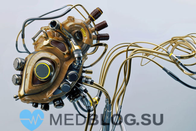 iskusstvennoe-serdtse-foto Искусственное сердце человека -миф или реальность