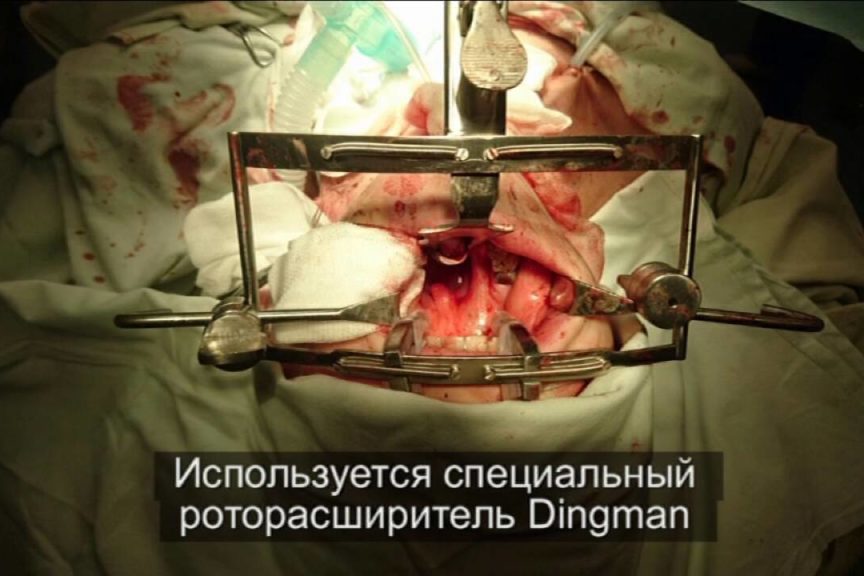 НОВОЕ В ОНКОЛОГИИ. Роботическая онкохирургия. Рак полости рта. Рак молочной железы.