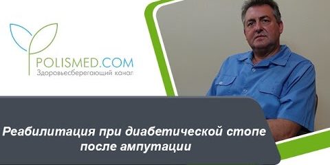 Реабилитация при диабетической стопе после ампутации: уход за культей, массаж, гимнастика