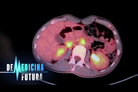 Ядерная медицина. Лечение радиацией | Медицина будущего