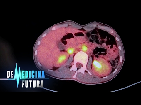 Ядерная медицина. Лечение радиацией | Медицина будущего