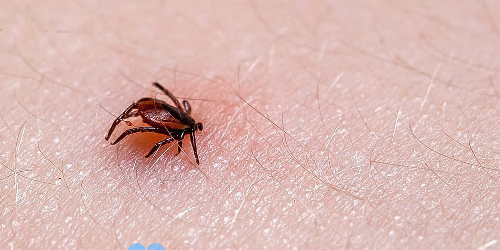 Боррелиоз или болезнь Лайма