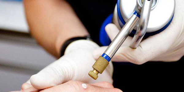 cryotherapy Криотерапия