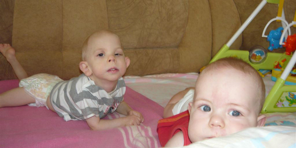 opitz Диагностика синдрома Опица