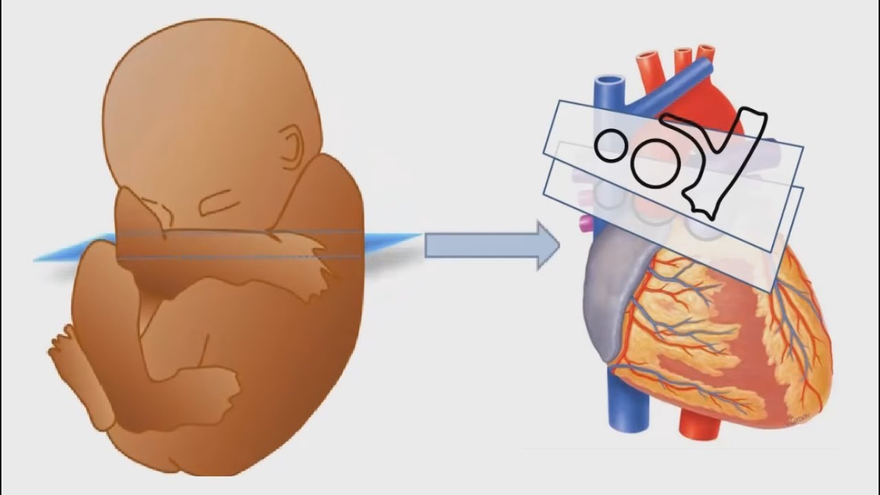 Сердце плода. Сердце плода анатомия. Ультразвуковая анатомия сердца. Анатомия сердца плода на УЗИ. Анатомия сердца плода в картинках.