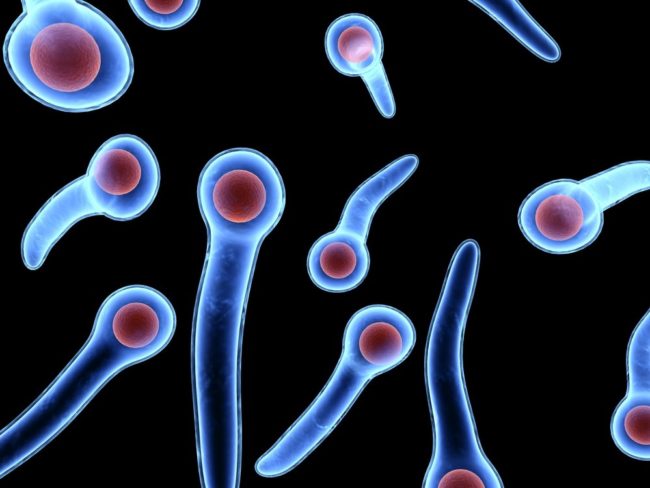 Ученые рассказали, как не навредить суставам