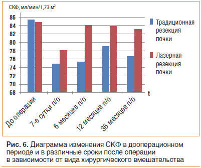 Рис. 6. Диаграмма изменения СКФ в дооперационном периоде и в различные сроки после операции в зависимости от вида хирургического вмешательства