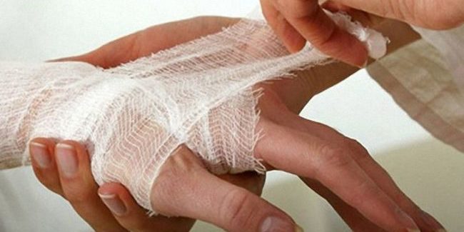 Первая помощь при ожогах горячей водой