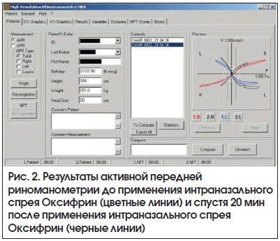 Рис. 2. Результаты активной передней риноманометрии до применения интраназального спрея Оксифрин (цветные линии) и спустя 20 мин после применения интраназального спрея Оксифрин (черные линии)