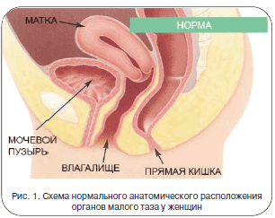 Рис. 1. Схема нормального анатомического расположения органов малого таза у женщин
