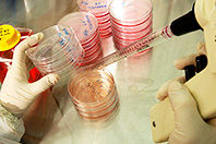 Ученые создали уникальные имплантаты для пересадки костного мозга