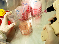 Ученые создали уникальные имплантаты для пересадки костного мозга