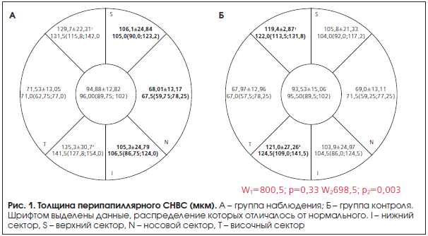 Рис. 1. Толщина перипапиллярного СНВС (мкм).