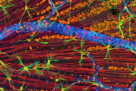 Витамин B3 предотвращает гибель нервных клеток при болезни Паркинсона