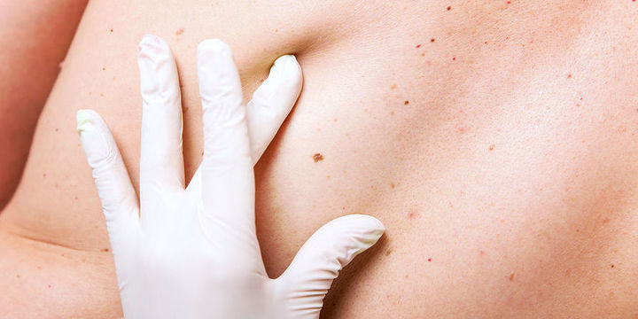 Крошечные пузырьки помогут победить рак