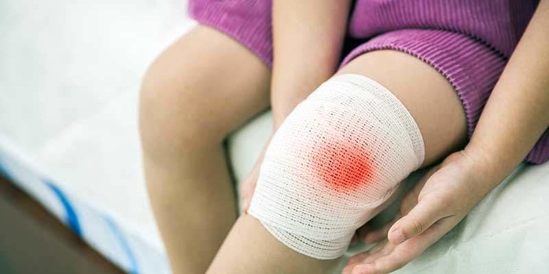 Что делать, если поранился: правила первой помощи