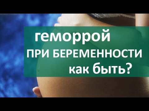 Геморрой у беременных. Проктолог ЦЭЛТ о геморрое у беременных женщин.