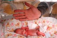 Недоношенные дети менее успешны во взрослой жизни