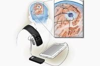 Уникальный имплантат справится с симптомами болезни Паркинсона