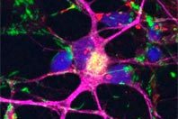 Витамин B3 предотвращает гибель нервных клеток при болезни Паркинсона