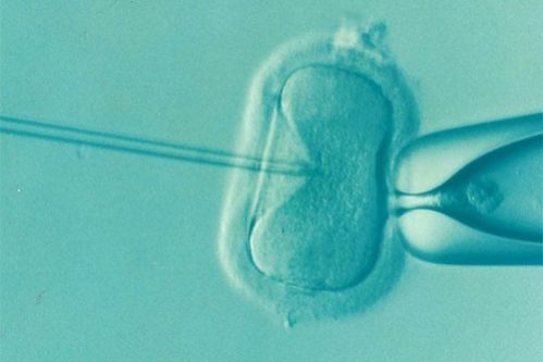 Дополнительная процедура, предлагаемая при искусственном оплодотворении, оказалась бесполезной — МедНовости