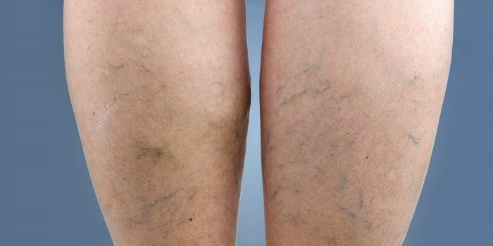 Названы уникальные свойства арбуза — Медицина 2.0