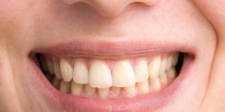 Стоматологи рассказали, что угрожает деснам