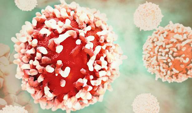 Ученые назвали болезнь, повышающую риск развития рака