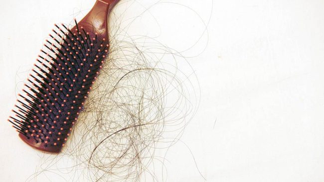 Потеря и выпадение волос