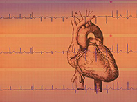 Уникальная футболка поможет предсказать остановку сердца за несколько дней до приступа