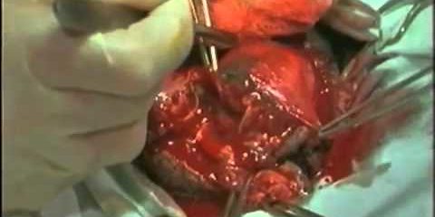 Военно полевая хирургия