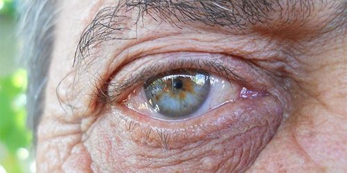 Возрастную слепоту можно предупредить при помощи диеты — МедНовости