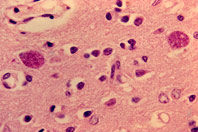 Заражение паразитами заставляет людей идти на риск