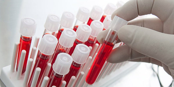 8 рекомендаций при сдаче крови на анализ
