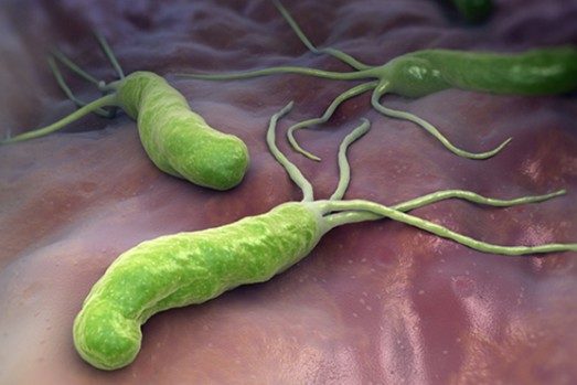 Медики рассказали, как неудачные браки разрушают здоровье