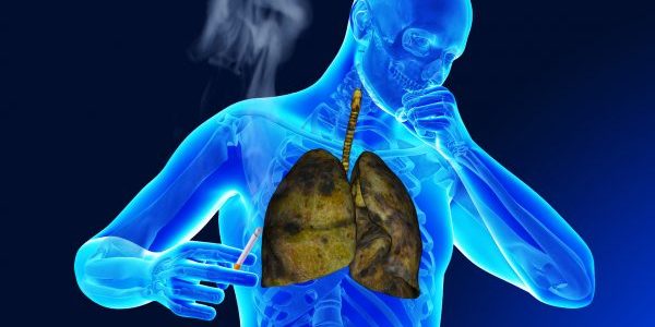 Генетики пролили свет на новые методы лечения рака легких