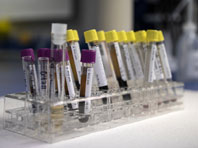 Анализ крови может показать людей, которых поразит рак почки