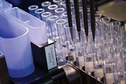 FDA предоставило статус «прорывная медицинская технология» тест-системе компании «Рош» для анализатора Elecsys для анализа спинномозговой жидкости с целью совершенствования диагностики болезни Альцгеймера