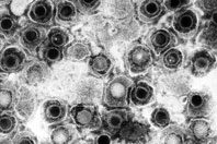 Специалисты поняли, что поможет вылечить вирус герпеса раз и навсегда