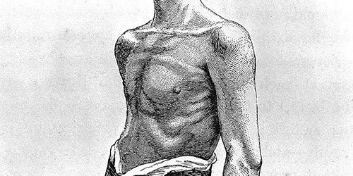 В России будет создан регистр пациентов с тяжелой бронхиальной астмой — МедНовости