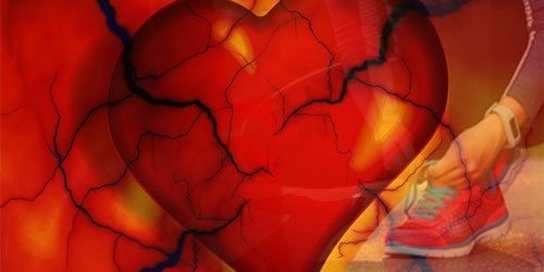 Хорошая физическая форма не спасает от болезней сердца — МедНовости