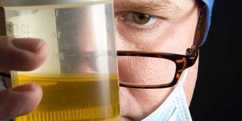 Неприятный запах у мочи: 8 возможных причин