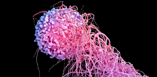 8 видов рака, которые можно определить по дыханию человека