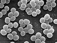 Биологи обнаружили новые бактерии, которые не боятся антибиотиков